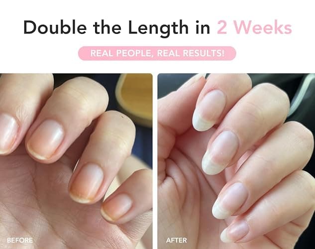 Liaison UltraGrow Nail Serum for Growth and Strength with Keratin Complex, Olive Oil & Vitamin E | Dermatologist-Tested to Support Weak, Brittle, Splitting Nails thumbnail 4