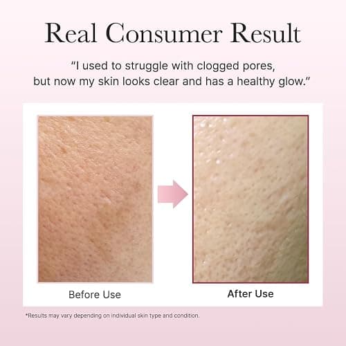 Fresh Rosehip Rice Mochi Cleanser thumbnail 6