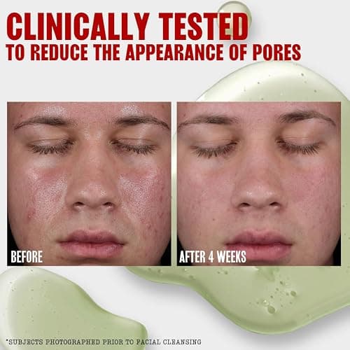 Thayers Oil Balancing and Cooling Jelly Toner, Pore Reducing Facial Toner That Mattifies and Hydrates, Skin Care for Combination to Oily Skin, 12 Fl Oz thumbnail 4