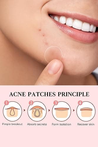 Invisible Acne Patches for Face – Hydrocolloid Acne Patches for Teen Girls & Boys, Best Acne Treatment for Face, Skin Care Stocking Stuffers for Teens, Women & Adults, Invisible Zit Patch thumbnail 7