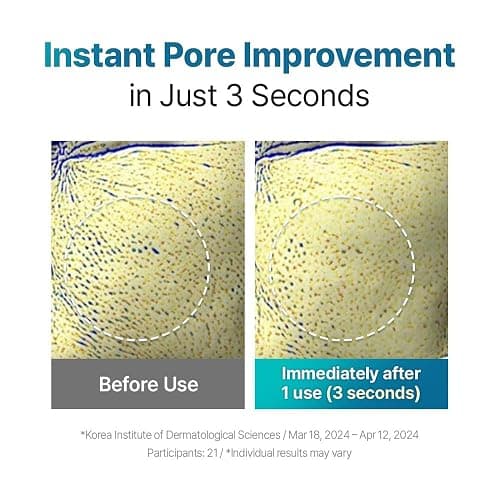 UIQ Biome Remedy Pore Reset Cooling Pad, Hydrating & Cooling Korean Toner Pads, Instant Cooling for Dry, Overheated skin, Pore Care with Panthenol, Allantoin, Niacinamide 80 Pads, 6.08 fl. oz. thumbnail 4