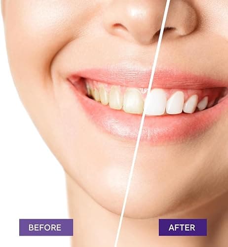 Teeth Whitening Purple Toothpaste- Toothpaste Whitening, Teeth Whitening Toothpaste, Purple Toothpaste Teeth Whitening, Tooth Whitening, Teeth Whitening Gel 30ml thumbnail 2