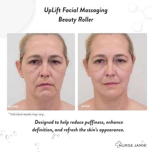 Nurse Jamie Uplift Facial Massaging Beauty Roller - Facial Massager with 24 Stones for Sculpting, Firming & Reducing Puffiness thumbnail 2