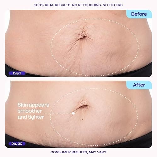 goPure Firming Belly Cream - Body Firming Moisturizer for Visible Cellulite & Stretch Mark Reduction, 4.25oz thumbnail 3