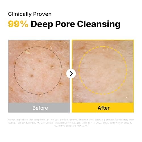 MANYO Pure Cleansing Oil, Natural Oil Cleanser for Face, Makeup Blackhead Remover, Korean Skin Care, 6.76 fl oz (200ml) thumbnail 5