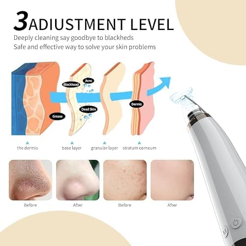 Blackhead Remover Pore Vacuum, Visual Rechargeable Blackhead Vacuum Facial Pore Cleaner-3 Suction Soft Silicone,3 Probes,USB Kit Electric Acne Extractor Tool for Adult thumbnail 4