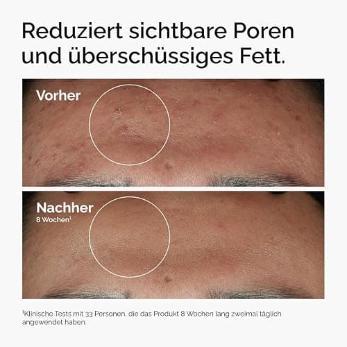 THE ORDINARY Niacinamid 10% + Zink 1%, 30ml thumbnail 2