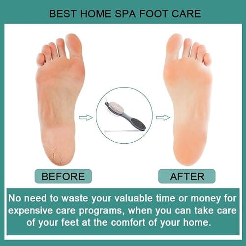 CAREHOOD Foot File Callus Remover - Multi Purpose 4 in 1 Feet Pedicure Tools with Foot Scrubber, Pumice Stone, Foot Rasp and Sand Paper for Home Foot Care (Grey Pedicure Foot File) thumbnail 6