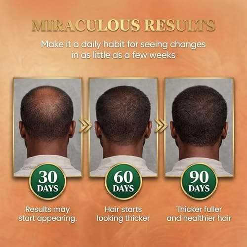 Batana Oil for Hair Growth Dr Sebi, 100% Raw Organic Batana Hair Mask from Honduras, Wild Growth Hair Oil, Scalp Oil Promotes Hair Thickness, Prevents Loss for Men & Women, 4.06 fl oz thumbnail 5