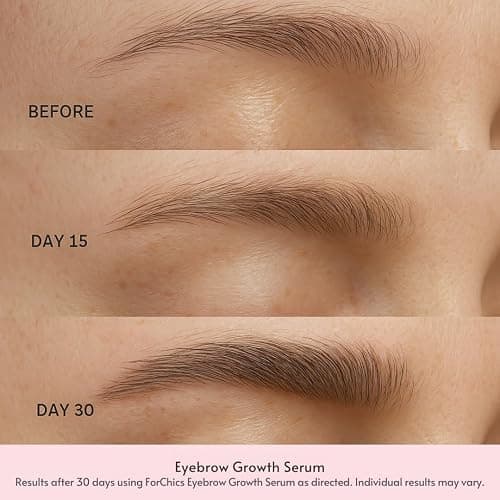 ForChics Eyebrow Growth Serum - Natural Brow Enhancer for Fuller, Thicker Brows in 2 Weeks - Vegan, Hormone-Free with Peptides and Biotin - No Prostaglandins - 3ml thumbnail 2