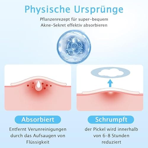 360 Stück Pickel Patch Hydrokolloid Acne Pimple Patches Anti-Akne Patch Unsichtbare für Tag & Nacht mit Teebaumöl, Salicylsäure,Centella Asiatica｜4 Größen 8 mm,10 mm,12 mm,14 mm thumbnail 9