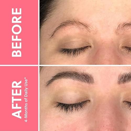 Lash & Brow Growth Bundle – Hormone-Free Enhancer for Longer Lashes & Fuller Brows – Vegan, Natural & Gentle Serum Duo for 24/7 Nourishment & Strengthening [2x 0.10 fl. oz / 3ml] thumbnail 6