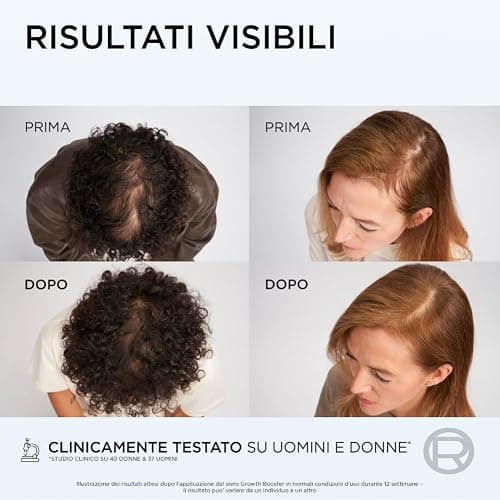L'Oréal Paris Elvive Shampoo Anti-Caduta Fortificante, Per Capelli Deboli e Tendenti alla Rottura, Caduta Ridotta 10X, Con Complesso Fortificante con Aminexil-R, Growth Booster, 200 ml thumbnail 6