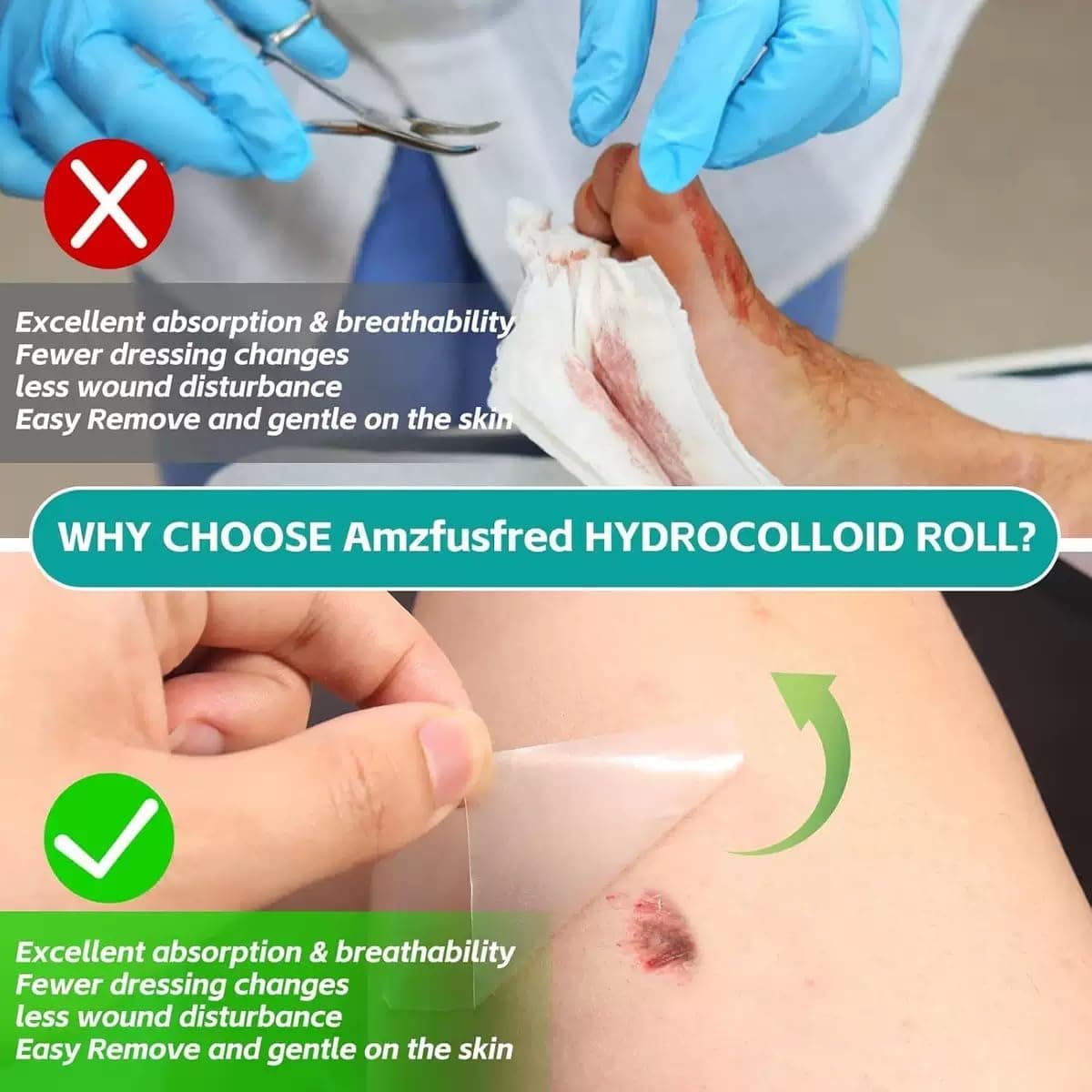 Hydrocolloid Roll for Wound Care, 5cm*3m Hydrocolloid Bandages Rolls Tape, Waterproof and Ultra Absorbent Patch Bandages Cut-to-Size, First Aid Kit Essential for Burn Blister (Color C) thumbnail 3