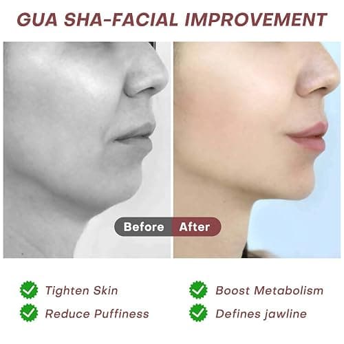 Gua Sha thumbnail 3