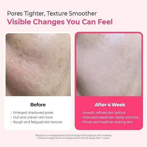 Dr.Melaxin Cemenrete Cyano Pink Spicule Serum with Calcium, korean skin care pore tightening refines spicule microneedling serum 1.01 fl. oz. thumbnail 4