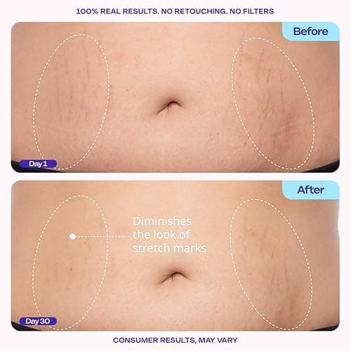 goPure Firming Belly Cream - Body Firming Moisturizer for Visible Cellulite & Stretch Mark Reduction, 4.25oz thumbnail 5