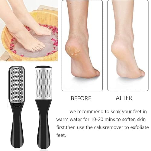36 in 1 Pedicure Kit, Professional Pedicure Tools Foot Rasp Foot Dead Skin Remover for Home & Salon Care thumbnail 4