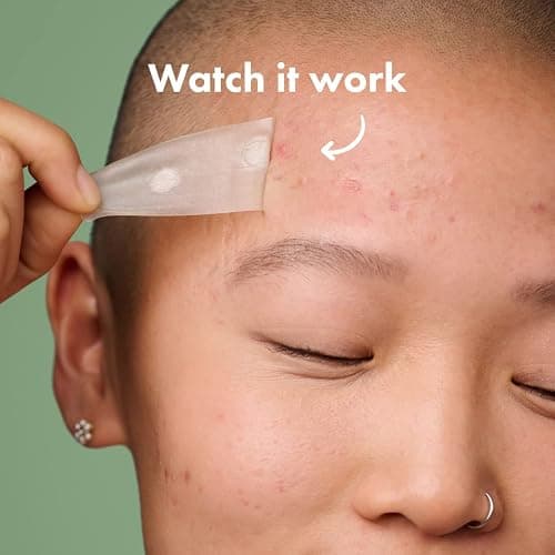 Mighty Patch Surface Large Pimple Patches for Face from Hero Cosmetics, Acne Spot for Body, Cheek, Forehead, and Chin, Pimple Stickers, Hydrocolloid Covers, Vegan-friendly, 10 Count thumbnail 4