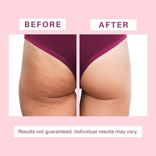 Anti Cellulite Brush, Massager & Body Scrubber for Toning & Firming by M3 | Silicone Cellulite Brush for Thighs & Butt Firming, Skin Smoothing, Exfoliating, Circulation, Hair & Scalp Massage thumbnail 3
