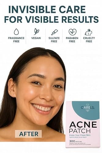 Invisible Acne Patches for Face – Hydrocolloid Acne Patches for Teen Girls & Boys, Best Acne Treatment for Face, Skin Care Stocking Stuffers for Teens, Women & Adults, Invisible Zit Patch thumbnail 5