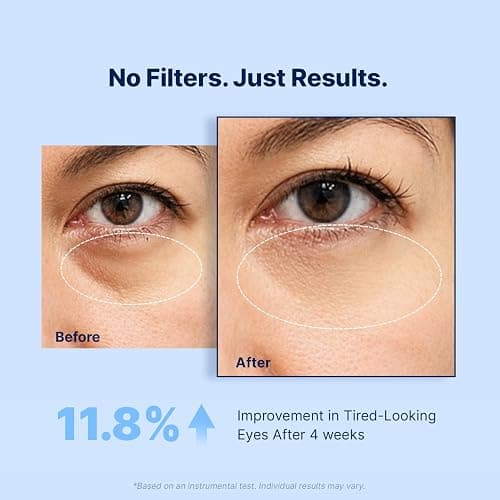 Under Eye Patches for Dark Circles: 30 Pairs Retinol Collagen Eye Gel Masks - Refreshing Under Eye Care for Appearance of Wrinkles & Puffiness - Gift for Moms Travelers Night Workers (Navy) thumbnail 4