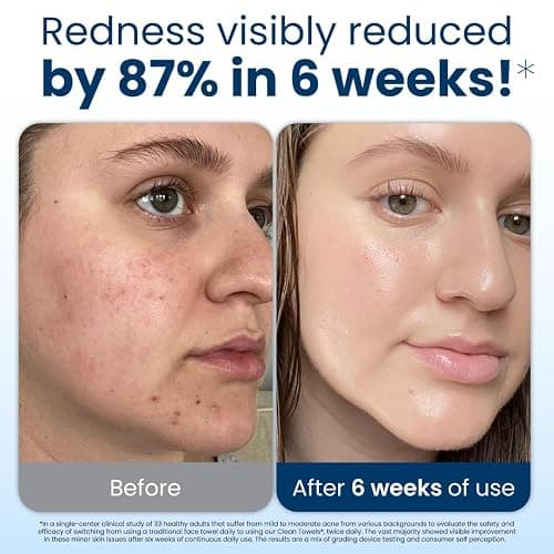 Clean Skin Club Clean Towels XL®, 100% USDA Biobased Face Towel, Disposable Face Towelette, Eczema Association Accepted, Makeup Remover Dry Wipes, Ultra Soft, 1 Pack, 50 Ct thumbnail 3