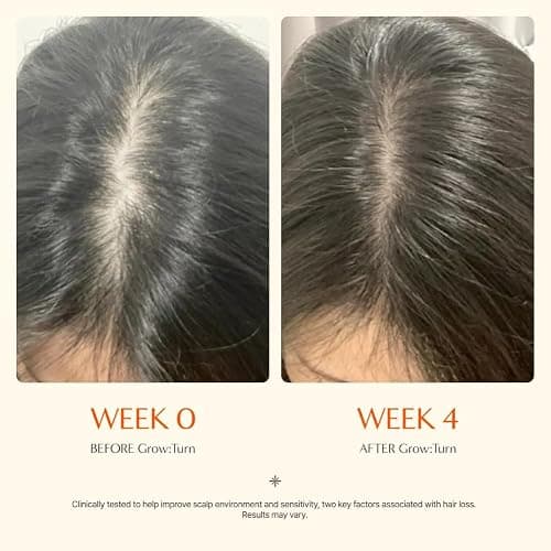 Growturn Hair Growth Serum with Built in Brush for Hair Growth & Thickening | Treatment for Thinning Hair, Hair Loss | Low Irritation, Fragrance-Free, Sulfate & Paraben-Free, 3.38 fl. oz. (Pack of 2) thumbnail 3