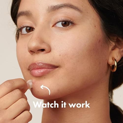 Mighty Patch™ Original patch from Hero Cosmetics – The #1 Hydrocolloid Acne Pimple Patch for Shrinking Zits and Whiteheads in 1 use; Nighttime Spot Stickers for Face and Skin (72 Count) thumbnail 10