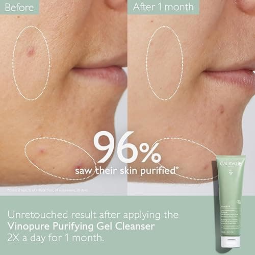 Caudalie Vinopure Salicylic Acid Cleanser, Pore Purifying Gel Cleanser - 150 mL thumbnail 4