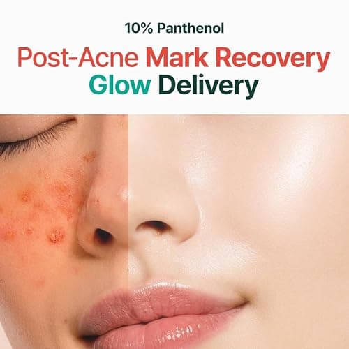 PURITO Post-Acne Moisturizer, Recovery & Glow Boost, Silicone-Free, Non-Comedogenic, Vegan, Korean Skincare, Mighty Bamboo Panthenol Cream, 3.38 fl oz / 100ml thumbnail 2