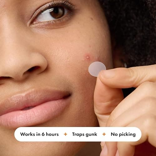 Mighty Patch™ Variety Pack from Hero Cosmetics - Hydrocolloid Acne Pimple Patches for Covering Zits and Blemishes, Spot Stickers for Face and Skin, Korean Skin Care, 26 ct thumbnail 3