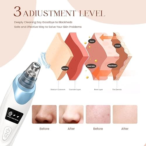 2025 Blackhead Remover Pore Vacuum,Facial Pore Cleaner-5 Suction Power,5 Probes,USB Rechargeable Blackhead Vacuum Kit Electric Acne Extractor Tool for Adult thumbnail 3