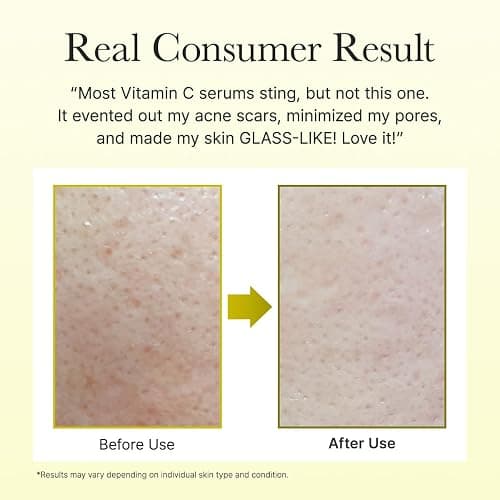 Arencia Vitamin C Booster Shot Serum with Glutathione, Niacinamide and Vitamin E for Dark Spot Care, Fine Lines & Wrinkles, Glass Skin, Korean Skincare 30ml/1.01 fl.oz thumbnail 7