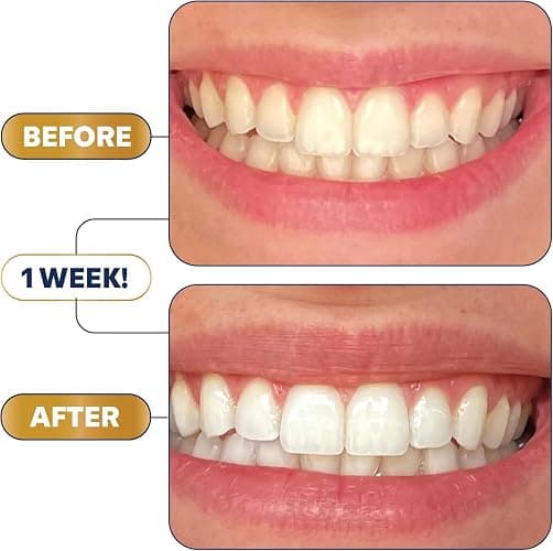 Lumineux Teeth Whitening Strips Kit - 9 Treatments (1 Month) - Peroxide Free - Enamel Safe for Whiter Teeth - Whitening Without The Sensitivity - Dentist Formulated - Sensitivity Free thumbnail 6