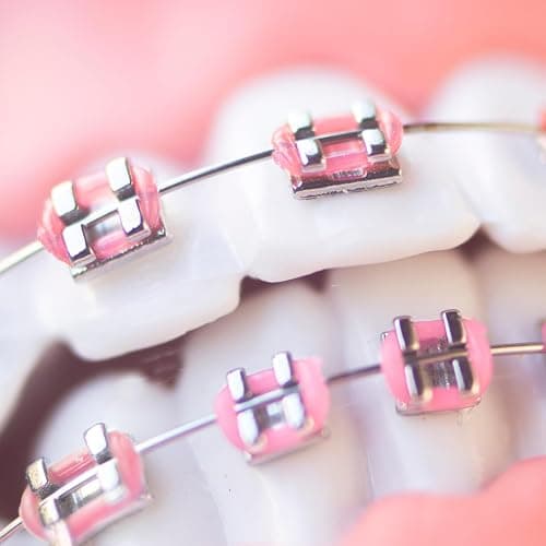 TrelaCo 1 Pack Fake Braces Artificial Tooth Decoration with Metal Wires Metal Bracket and Orthodontic Ligature Ties Practice Props for Dental Students Orthodontist Explain Props(Pink,Without Hook) thumbnail 4