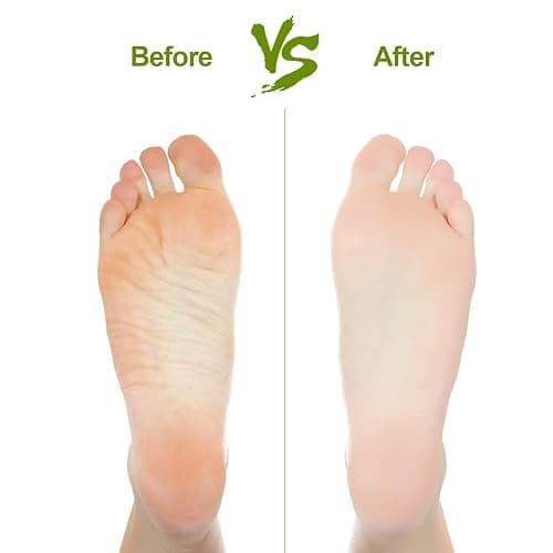 2PCS Natural Pumice Stone, Asqraqo Lava Pedicure Tools Hard Skin Callus Remover for Feet and Hands - Foot File Exfoliation to Remove Dead Skin, and Callusess thumbnail 6