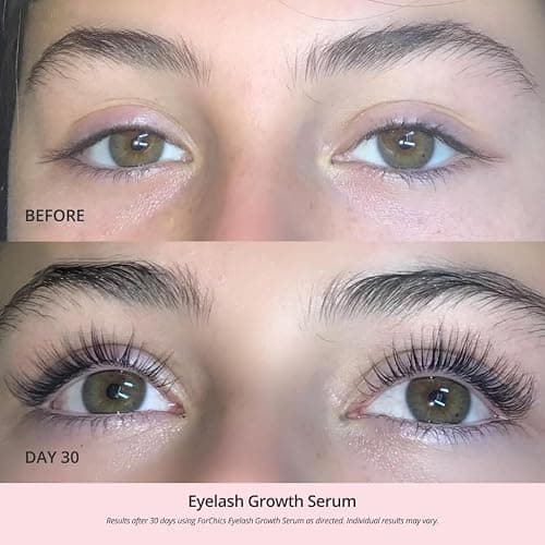 ForChics Eyelash Growth Serum - Prostaglandin-Free Lash Enhancing Serum for Longer, Thicker Lashes and Brows- Natural Formula, Visible Results in 2 Weeks - Vegan, Hormone-Free 0.10 fl. oz / 3ml thumbnail 4