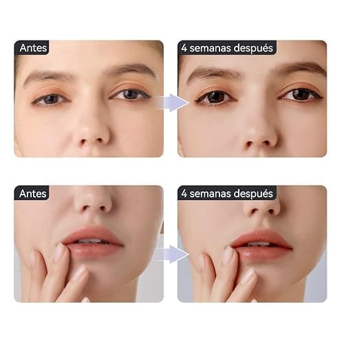 ANLAN Masajeador de Ojos, EMS Dispositivo de Ojos Antiarrugas y Antiedad, Luz Roja& Azu de LED Terapia, 40 ℃ Compresa Caliente, Mejora Ojeras, Bolsas, Hinchazón, Arrugas, Contorno de Ojos thumbnail 6