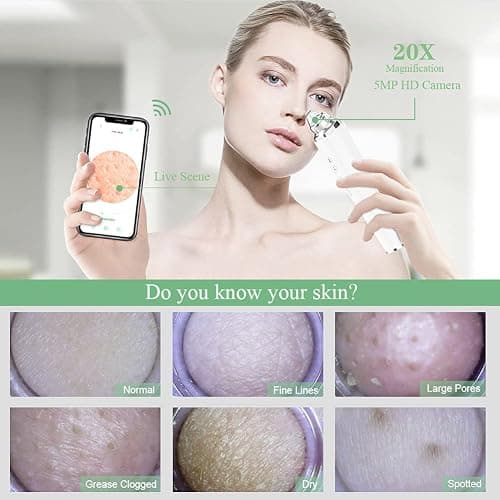 Blackhead Remover Pore Vacuum, 【[FDA Certification] 】 WiFi Visible Facial Pore Cleanser with HD Camera Pimple Acne Comedone Extractor Kit with 6 Suction Heads Electric Blackhead Suction Tool thumbnail 2