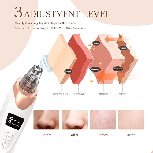 2025 Blackhead Remover Pore Vacuum,Facial Pore Cleaner-5 Suction Power,5 Probes,USB Rechargeable Blackhead Vacuum Kit Electric Acne Extractor Tool for Adult thumbnail 3