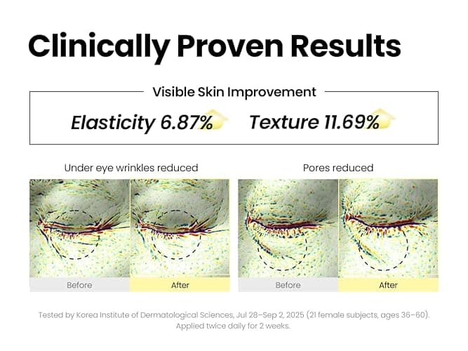 K-SECRET SEOUL 1988 Retinal Serum – Formulated with Advanced Retinal Liposome 2% and 58% Black Ginseng Extract | Fine Lines and Skin Texture Care Serum | Korean Skincare, 30ml / 1.01 fl oz thumbnail 4