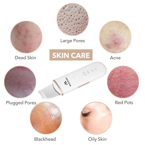 Skin Scrubber Face Skin Spatula Facial Scrubber Spatula for Deep Cleansing Blackhead Remover Pore Cleaner with 4 Modes (White) thumbnail 3