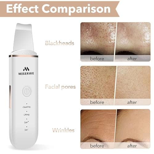 Skin Scrubber Face Skin Spatula Facial Scrubber Spatula for Deep Cleansing Blackhead Remover Pore Cleaner with 4 Modes (White) thumbnail 4