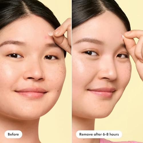 Mighty Patch Mini Invisible+ Patches - X-Small Daytime Hydrocolloid Acne Pimple Patches for Covering Zits & Blemishes, Blends Into Skin & Barely There (30 Count, 10mm Patch) thumbnail 5