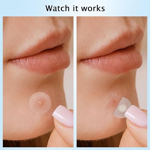 360 Stück Pickel Patch Hydrokolloid Acne Pimple Patches Anti-Akne Patch Unsichtbare für Tag & Nacht mit Teebaumöl, Salicylsäure,Centella Asiatica｜4 Größen 8 mm,10 mm,12 mm,14 mm thumbnail 5