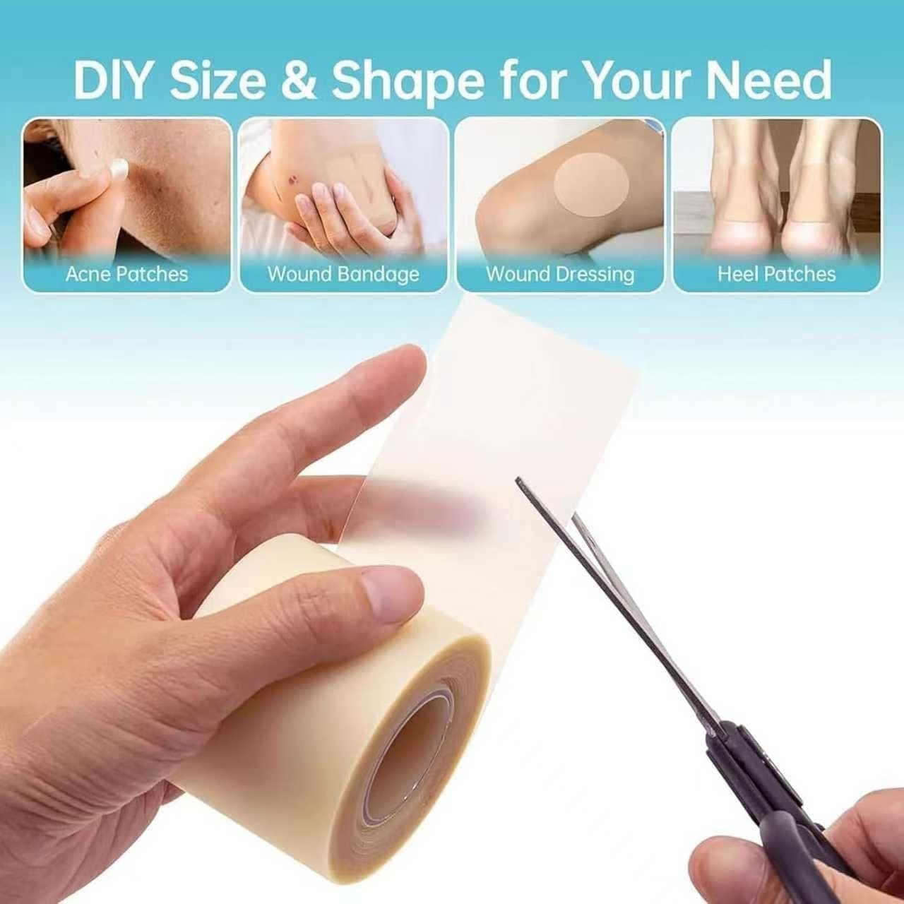 Hydrocolloid Roll for Wound Care, 5cm*3m Hydrocolloid Bandages Rolls Tape, Waterproof and Ultra Absorbent Patch Bandages Cut-to-Size, First Aid Kit Essential for Burn Blister (Color C) thumbnail 2