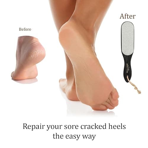 Pumice Stone Foot Scrubber - Pedicure Foot File with Handle for Dry Dead Skin - Callus Remover for Feet - Foot Scraper - Exfoliating Brush for Heels, Elbows, Hands thumbnail 5
