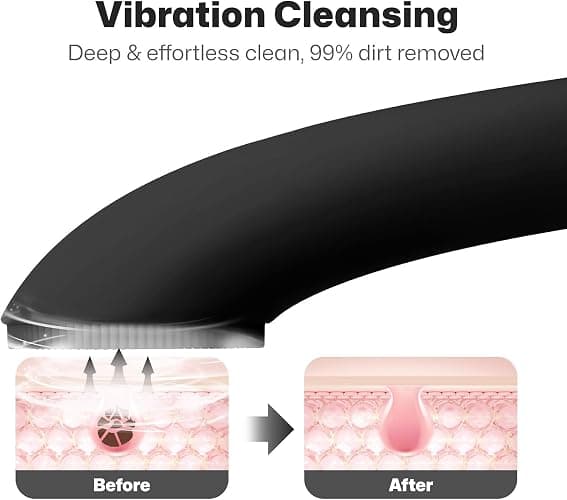 PRITECH Facial Cleansing Brush, Rechargeable Silicone Face Scrubber with Heat Massage End, Vibrating Exfoliator Scrubber for Deep Cleaning, Waterproof Face Brush for Women and Men (Black) thumbnail 2