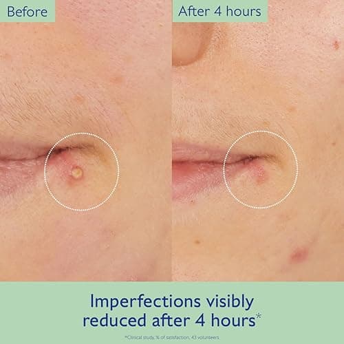 Caudalie Vinopure Targeted Spot Solution with Salicylic Acid - 15 mL thumbnail 4